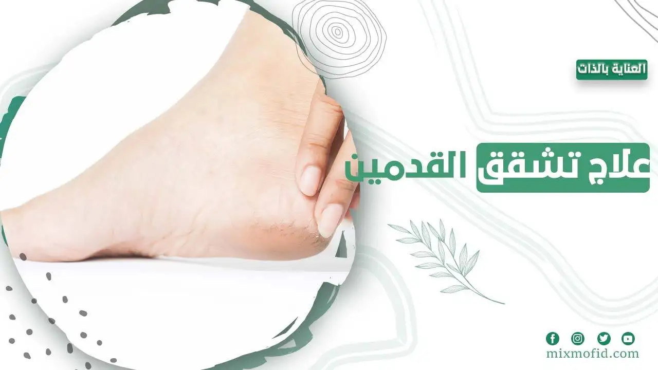 علاج تشقق القدمين وتنعيمهم
