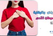 اعراض سرطان الثدي