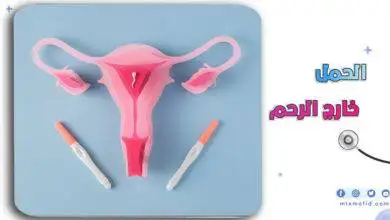 الحمل خارج الرحم