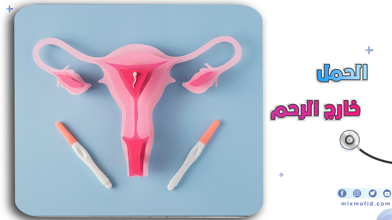 الحمل خارج الرحم
